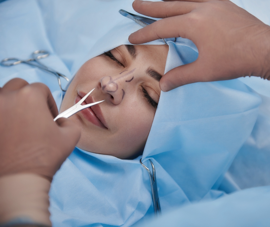 تجميل الأنف